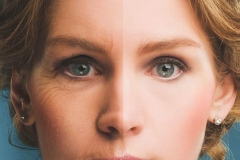 Wrinklers